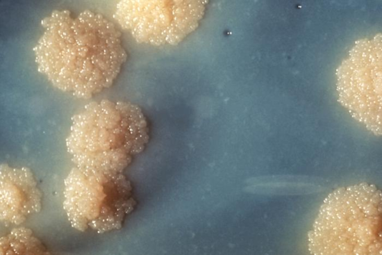 Tuberculosis Case Confirmed at Lane Middle School in Southeast Portland, Health Officials Provide Guidance and Testing