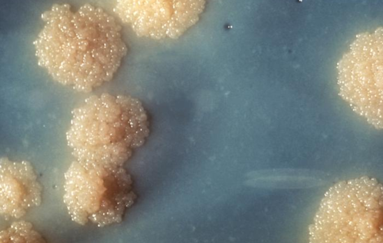 Tuberculosis Case Confirmed at Lane Middle School in Southeast Portland, Health Officials Provide Guidance and Testing