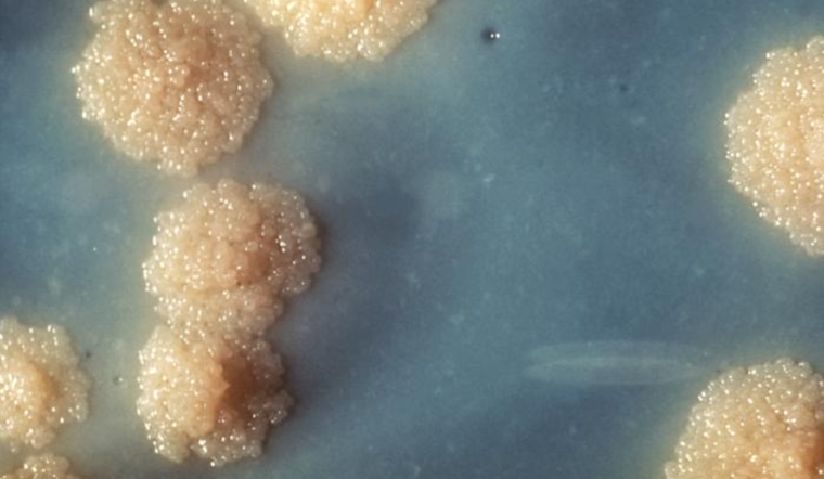 Tuberculosis Case Confirmed at Lane Middle School in Southeast Portland, Health Officials Provide Guidance and Testing