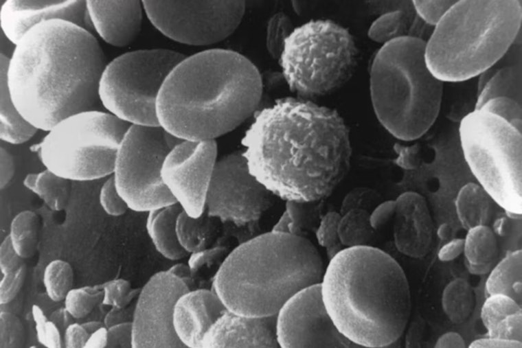 Breakthrough Study by UC and Case Western Develops Synthetic Platelets to Aid in Traumatic Brain Injury Treatment