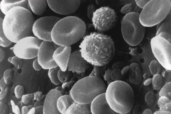 Breakthrough Study by UC and Case Western Develops Synthetic Platelets to Aid in Traumatic Brain Injury Treatment