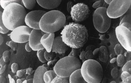 Breakthrough Study by UC and Case Western Develops Synthetic Platelets to Aid in Traumatic Brain Injury Treatment