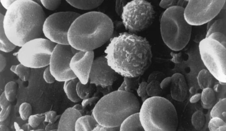 Breakthrough Study by UC and Case Western Develops Synthetic Platelets to Aid in Traumatic Brain Injury Treatment