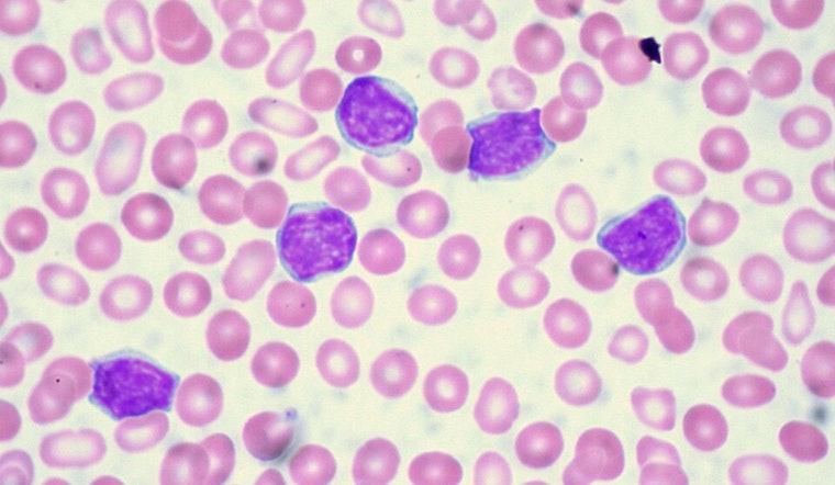 Cincinnati Breakthrough: Novel Drug 'Bexobrutideg' Stuns with Success in CLL Battle