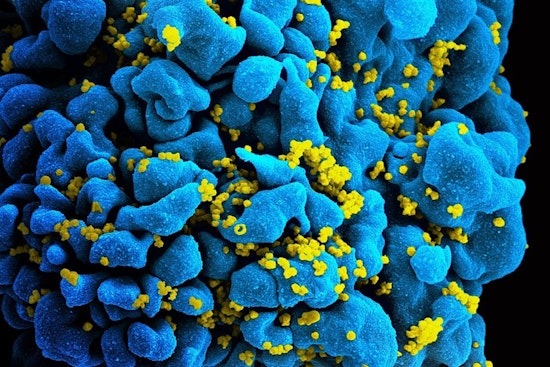 Cleveland Marks June 5 as HIV Long-Term Survivors Awareness Day in Honor of Resilience and Remembrance