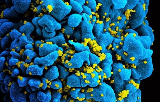 Cleveland Marks June 5 as HIV Long-Term Survivors Awareness Day in Honor of Resilience and Remembrance