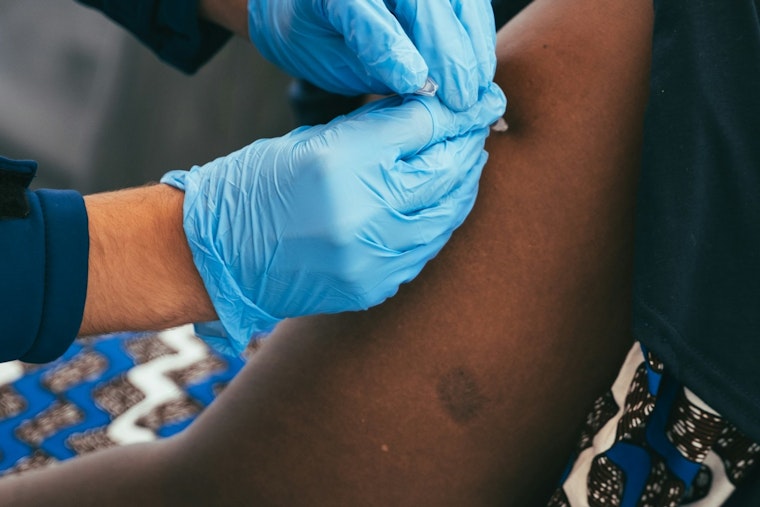 Long Beach Reports First Measles Case Since 2019, Health Officials Urge Vaccinations
