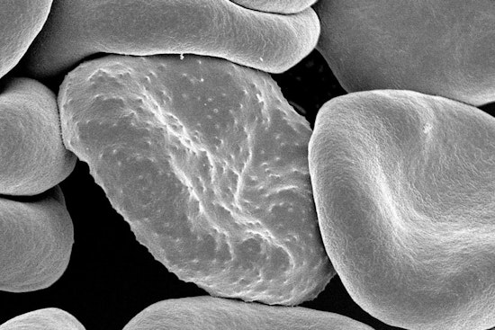 Revolutionary Paper-Based Device from Ohio State University Takes Malaria Diagnosis to New Heights in Ghana