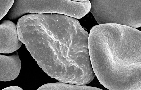 Revolutionary Paper-Based Device from Ohio State University Takes Malaria Diagnosis to New Heights in Ghana