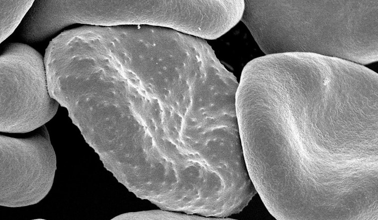 Revolutionary Paper-Based Device from Ohio State University Takes Malaria Diagnosis to New Heights in Ghana