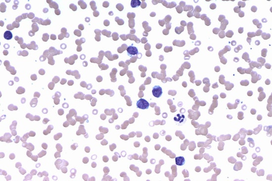 University of Cincinnati Study Unveils Breakthrough in Lymphoma Growth Mechanism, Paving Way for Targeted Treatments