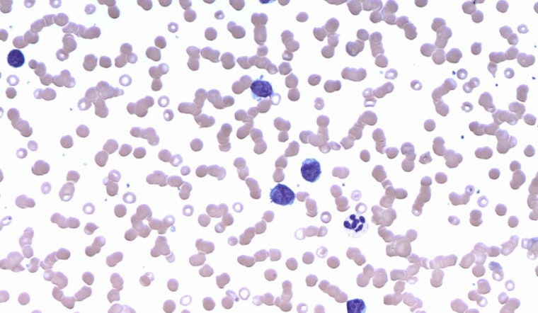 University of Cincinnati Study Unveils Breakthrough in Lymphoma Growth Mechanism, Paving Way for Targeted Treatments
