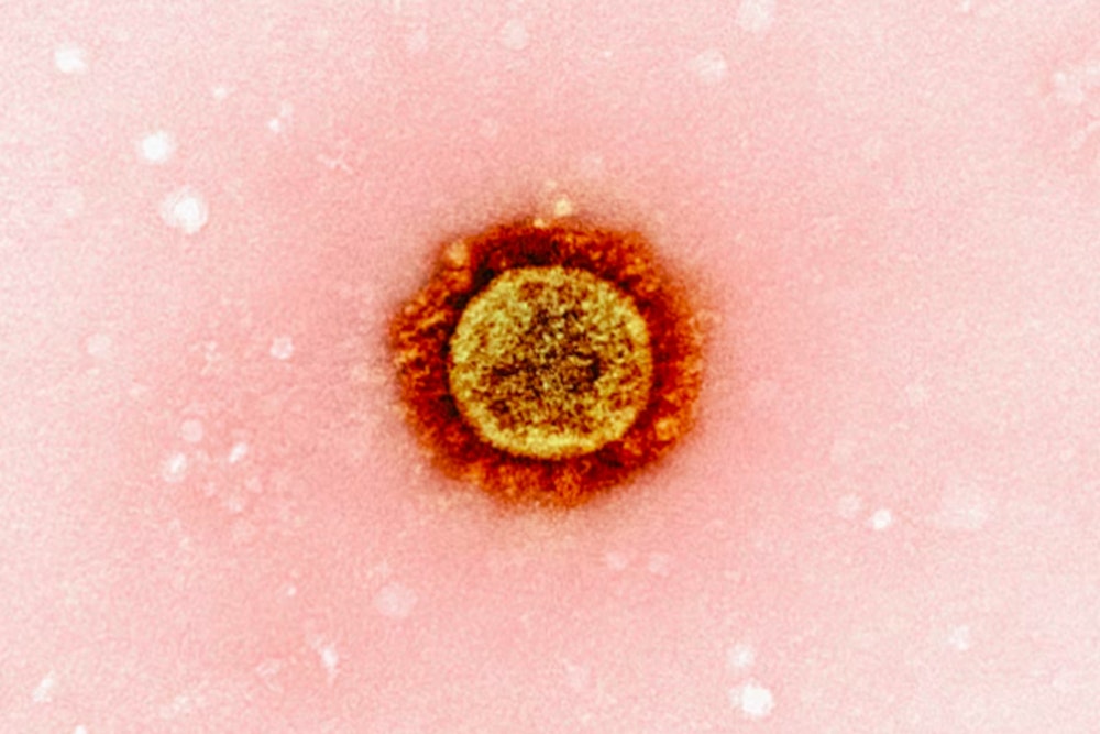 First Death from Pneumonic Plague in Arizona Since 2007 Confirmed in Coconino County