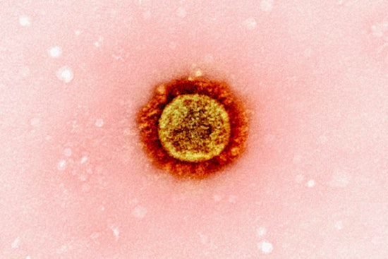 First Death from Pneumonic Plague in Arizona Since 2007 Confirmed in Coconino County