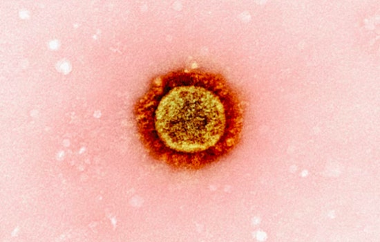 First Death from Pneumonic Plague in Arizona Since 2007 Confirmed in Coconino County