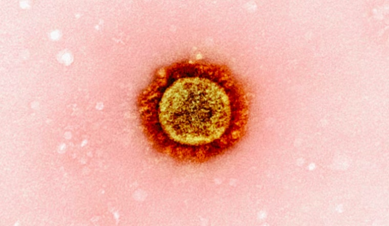 First Death from Pneumonic Plague in Arizona Since 2007 Confirmed in Coconino County