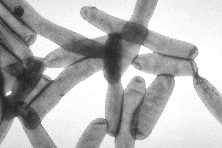 Health Alert as Central Harlem Investigates Five Legionnaires' Disease Cases with No Fatalities Reported