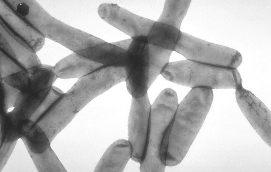 Health Alert as Central Harlem Investigates Five Legionnaires' Disease Cases with No Fatalities Reported