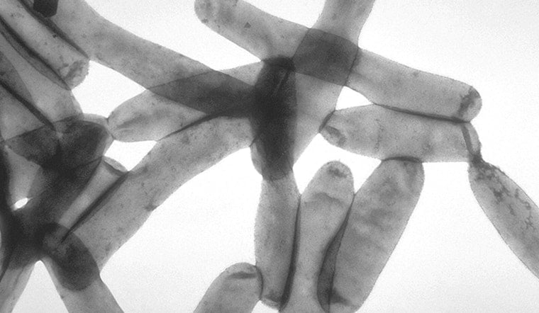 Health Alert as Central Harlem Investigates Five Legionnaires' Disease Cases with No Fatalities Reported