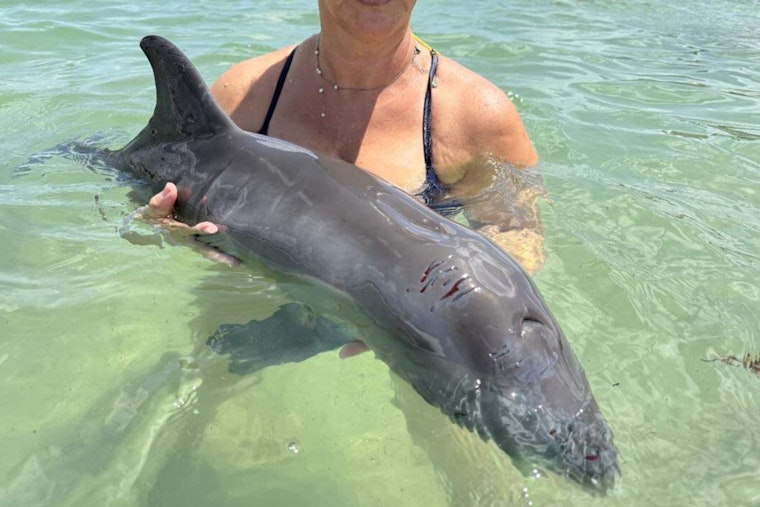 Lifeguards and Fire Rescue Crews Heroically Save Injured Dolphin Beached at Haulover Beach