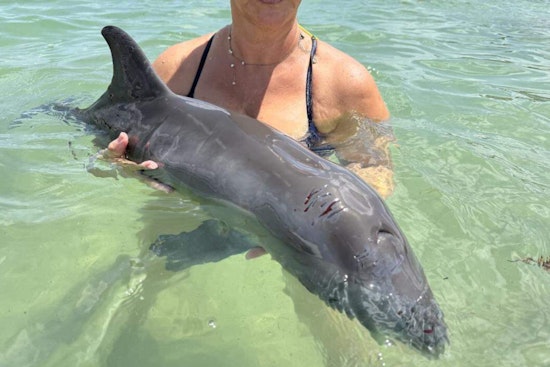 Lifeguards and Fire Rescue Crews Heroically Save Injured Dolphin Beached at Haulover Beach