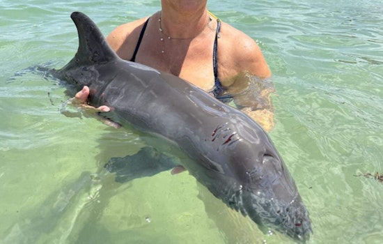 Lifeguards and Fire Rescue Crews Heroically Save Injured Dolphin Beached at Haulover Beach