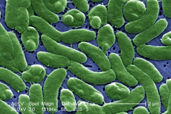 Buzzards Bay Visitors Beware, Rare Vibrio Bacteria Threat Rises with Temperature in Massachusetts Coastal Waters