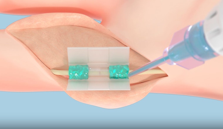 FDA Greenlights Tissium's Revolutionary Suture-Free Surgery Tech Developed at MIT
