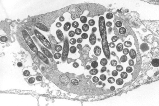 Legionnaires' Outbreak in Harlem Claims Sixth Life as Case Count Reaches 111 and City Remediates Cooling Towers