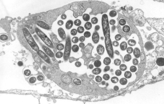 Legionnaires' Outbreak in Harlem Claims Sixth Life as Case Count Reaches 111 and City Remediates Cooling Towers