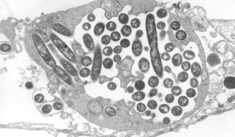 Legionnaires' Outbreak in Harlem Claims Sixth Life as Case Count Reaches 111 and City Remediates Cooling Towers
