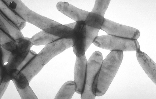 Second Death Confirmed in Legionnaires' Disease Outbreak in Harlem, NYC as 58 Cases Are Reported