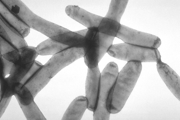 Third Death Confirmed in Central Harlem Legionnaires' Disease Outbreak as Cases Rise to 67