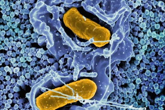 CDC Issues Warning to Discard Certain "Metabolic Meals" Amid Multi-State Salmonella Outbreak