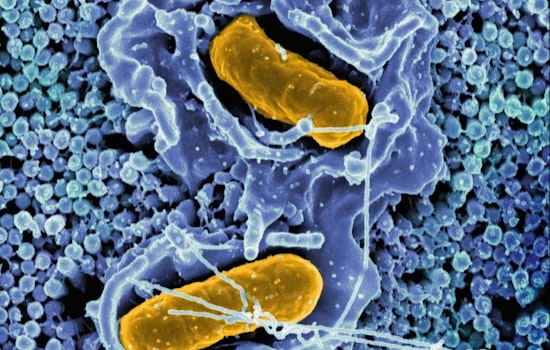 CDC Issues Warning to Discard Certain "Metabolic Meals" Amid Multi-State Salmonella Outbreak
