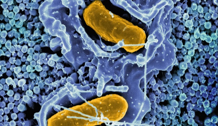 CDC Issues Warning to Discard Certain "Metabolic Meals" Amid Multi-State Salmonella Outbreak