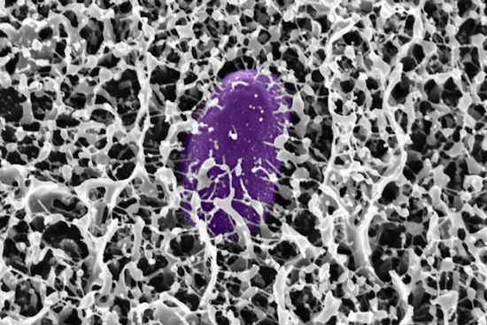 MIT Scientists' Sticky Solution, Mucus Molecule Might Defend Against Gastrointestinal Invaders