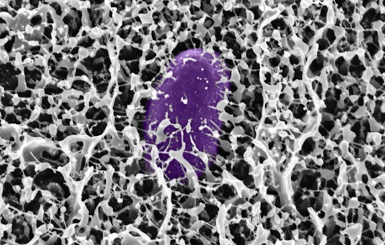 MIT Scientists' Sticky Solution, Mucus Molecule Might Defend Against Gastrointestinal Invaders