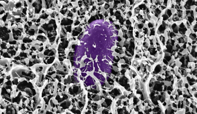 MIT Scientists' Sticky Solution, Mucus Molecule Might Defend Against Gastrointestinal Invaders