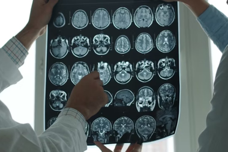 MIT Unveils MultiverSeg, A Groundbreaking AI System to Revolutionize Medical Image Segmentation