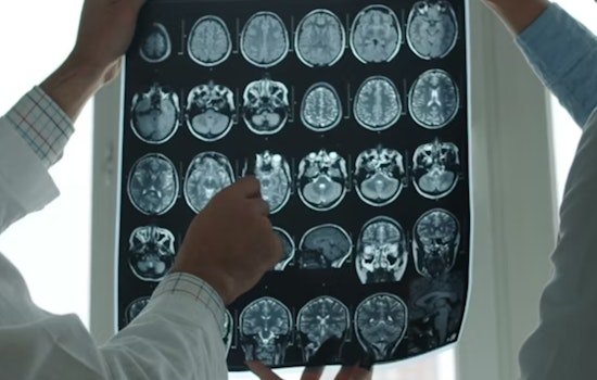 MIT Unveils MultiverSeg, A Groundbreaking AI System to Revolutionize Medical Image Segmentation