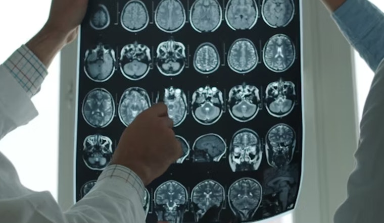MIT Unveils MultiverSeg, A Groundbreaking AI System to Revolutionize Medical Image Segmentation