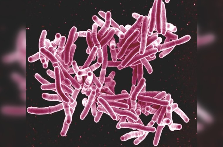 Tuberculosis Case at Indio High School Spurs Public Health Response in Riverside County