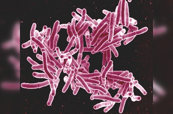 Tuberculosis Case at Indio High School Spurs Public Health Response in Riverside County