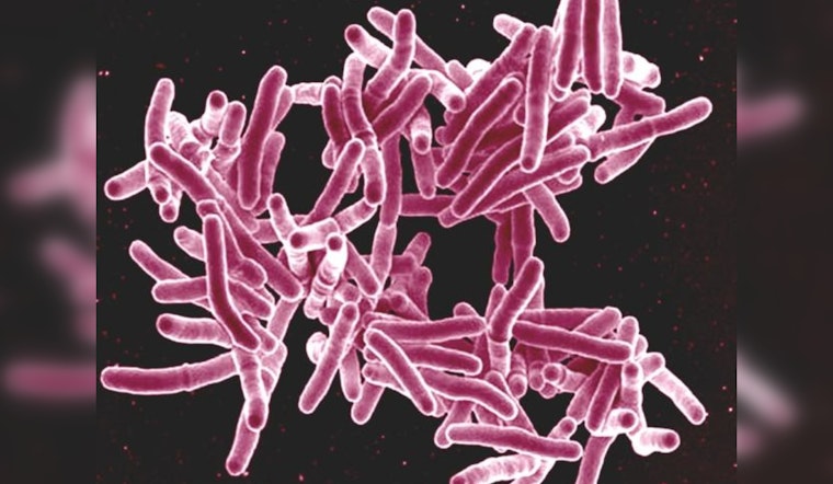 Tuberculosis Case at Indio High School Spurs Public Health Response in Riverside County