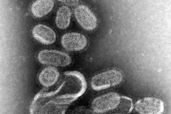 Arizona on High Alert as 'Super Flu' Variant Drives Spike in Cases, Affecting Younger Population