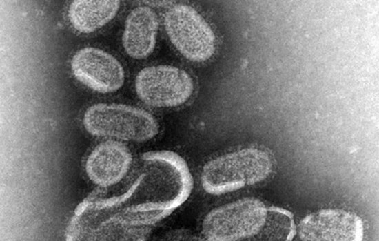 Arizona on High Alert as 'Super Flu' Variant Drives Spike in Cases, Affecting Younger Population