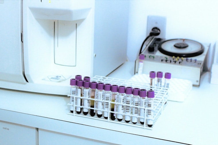 Dallas Cancer Test Boss Hit With SEC Fraud Suit Over Investor Millions