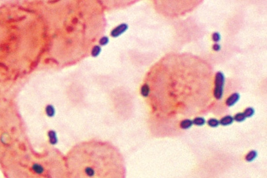 Health Advisory Issued for Palm Beach County Beaches Due to Elevated Enterococcus Bacteria Levels