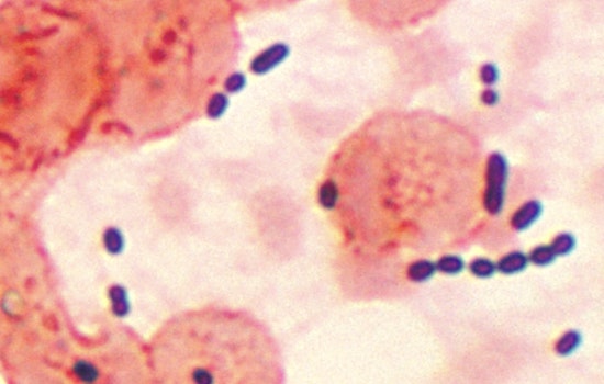 Health Advisory Issued for Palm Beach County Beaches Due to Elevated Enterococcus Bacteria Levels